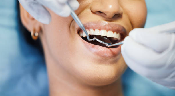 Best Knocked-Out Tooth (Avulsed Tooth) Treatment in North Amityville, NY