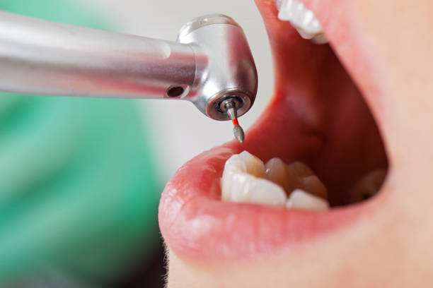 Best Emergency Denture Repair in North Amityville, NY